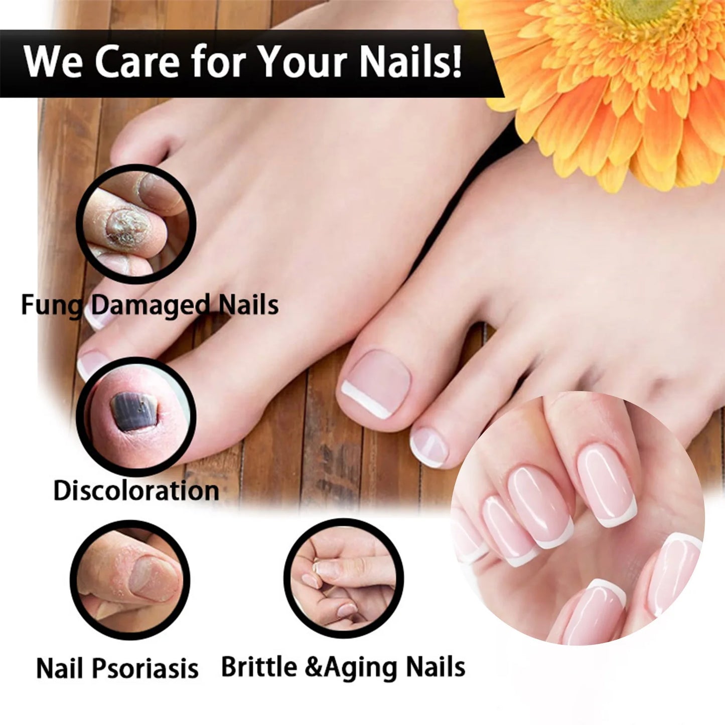 Nail Fungus Serum