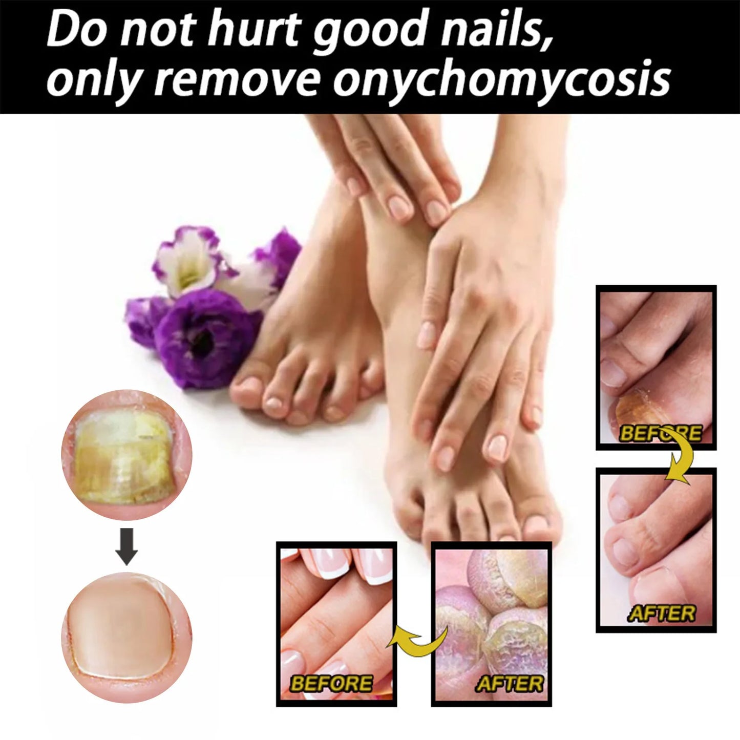 Nail Fungus Serum